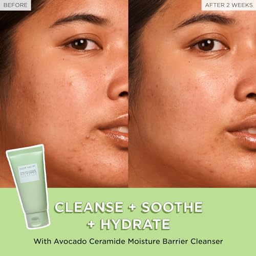 Fruit Babies Skincare Kit - Gift Set with Ceramide Facial Cleanser + BHA Toner + Vitamin C Eye Cream + Hyaluronic Acid Cream + Niacinamide Dew Drops (5 Count) - view 3