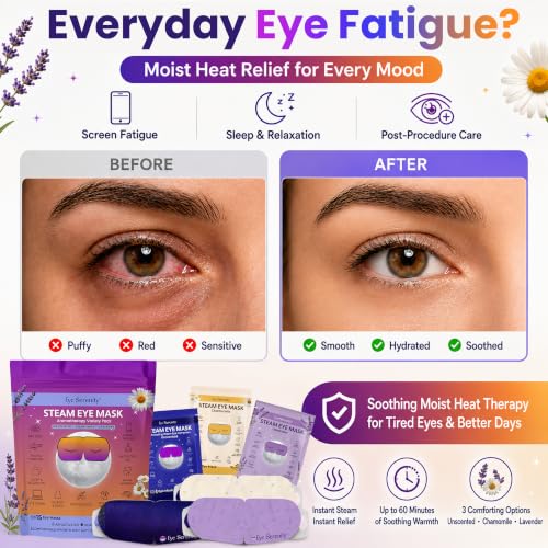Eye Serenity Steam Eye Mask, Heated Eye Mask Fast Relief for Stye, Variety - view 5
