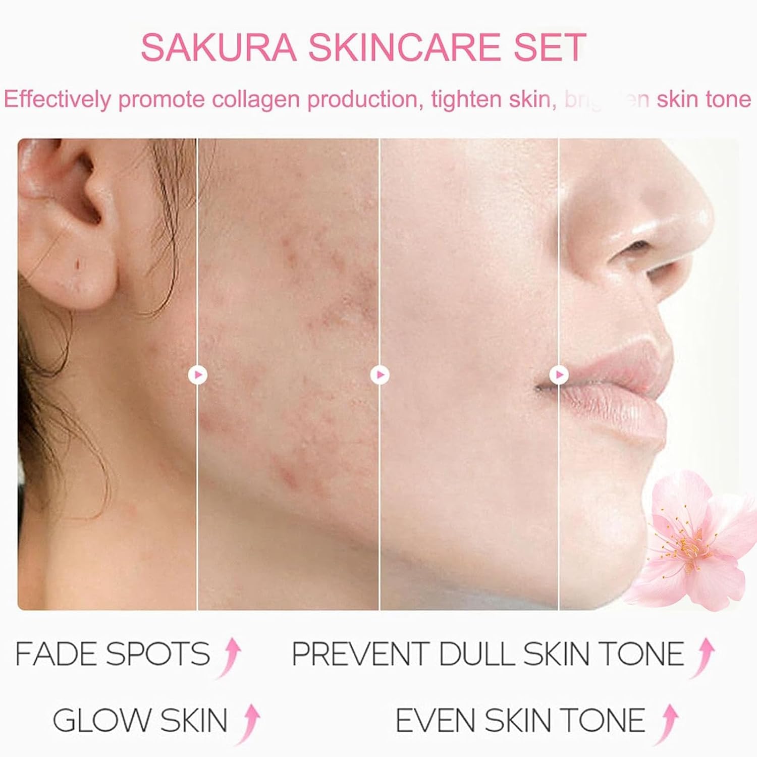 Skin care set, skin care for teens 10-12, travel essentials skincare gift set for women - cream, serum, eye mask, lip mask, 5 sleeping mask, 5 mud mask, hydrating teen skincare kit - view 5